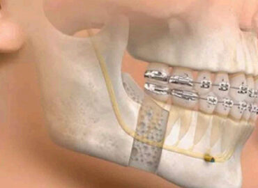 oral